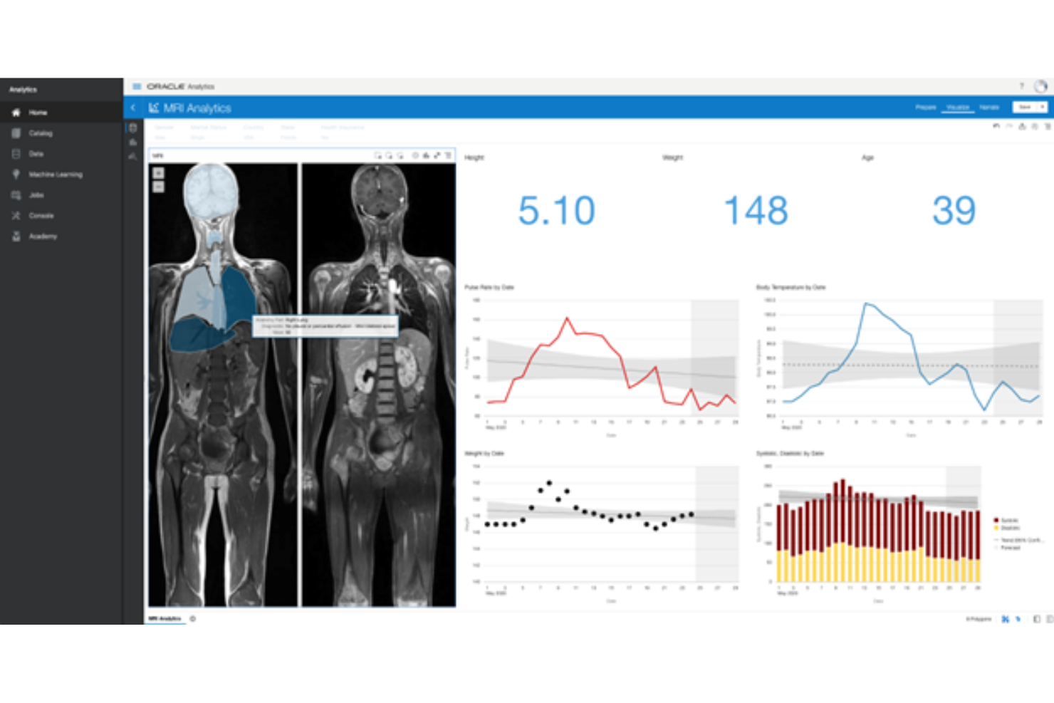 Oracle Analytics Cloud screenshot - 20 Best Self-Service BI Tools Reviewed For 2026